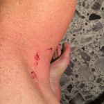 bleeding, iPhone, legs, shaved